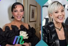 kris jenner face lift