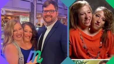 conjoined twins pregnant